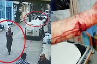 Bursa'da Pitbull Köpeği Saldırısına İlişkin İlginç Savunma