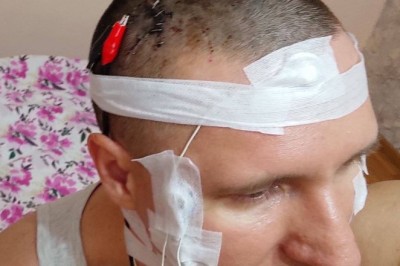 Rusya'da Adam Rüyalarını Kontrol Etmek İçin Kafasına Çip Taktı